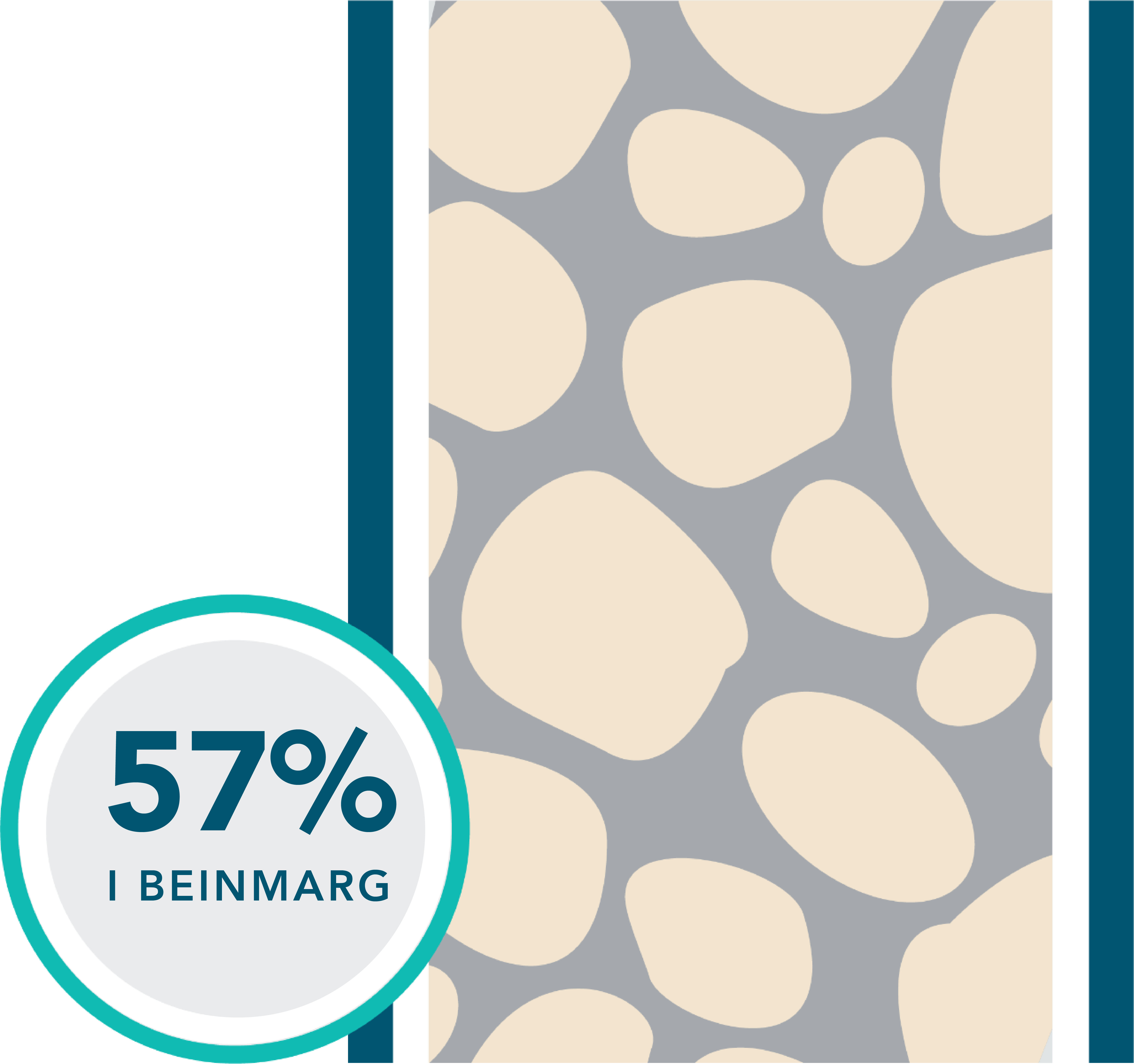 First-line VEN+O: 57% of patients had undetectable MRD in bone marrow